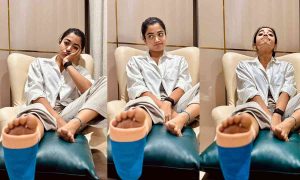Rashmika Mandanna Shares Health Update After Leg Injury: What's Next?