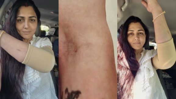 Actress Khushboo: Injuries suffered …Fans are worried..!