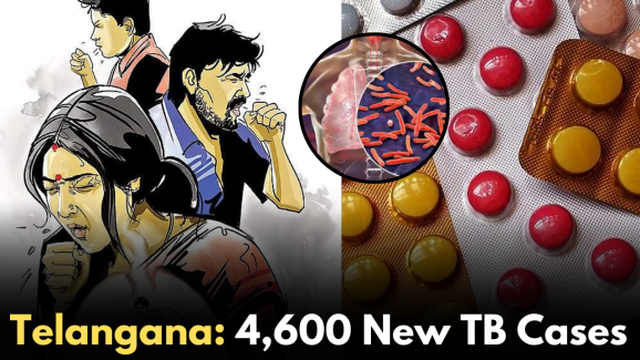Telangana: 4,600 New TB Cases Reported!