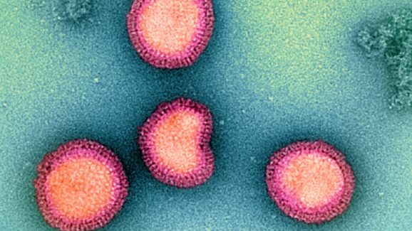 Human Coronavirus HKU1 Detected in Kolkata: Symptoms and Precautions