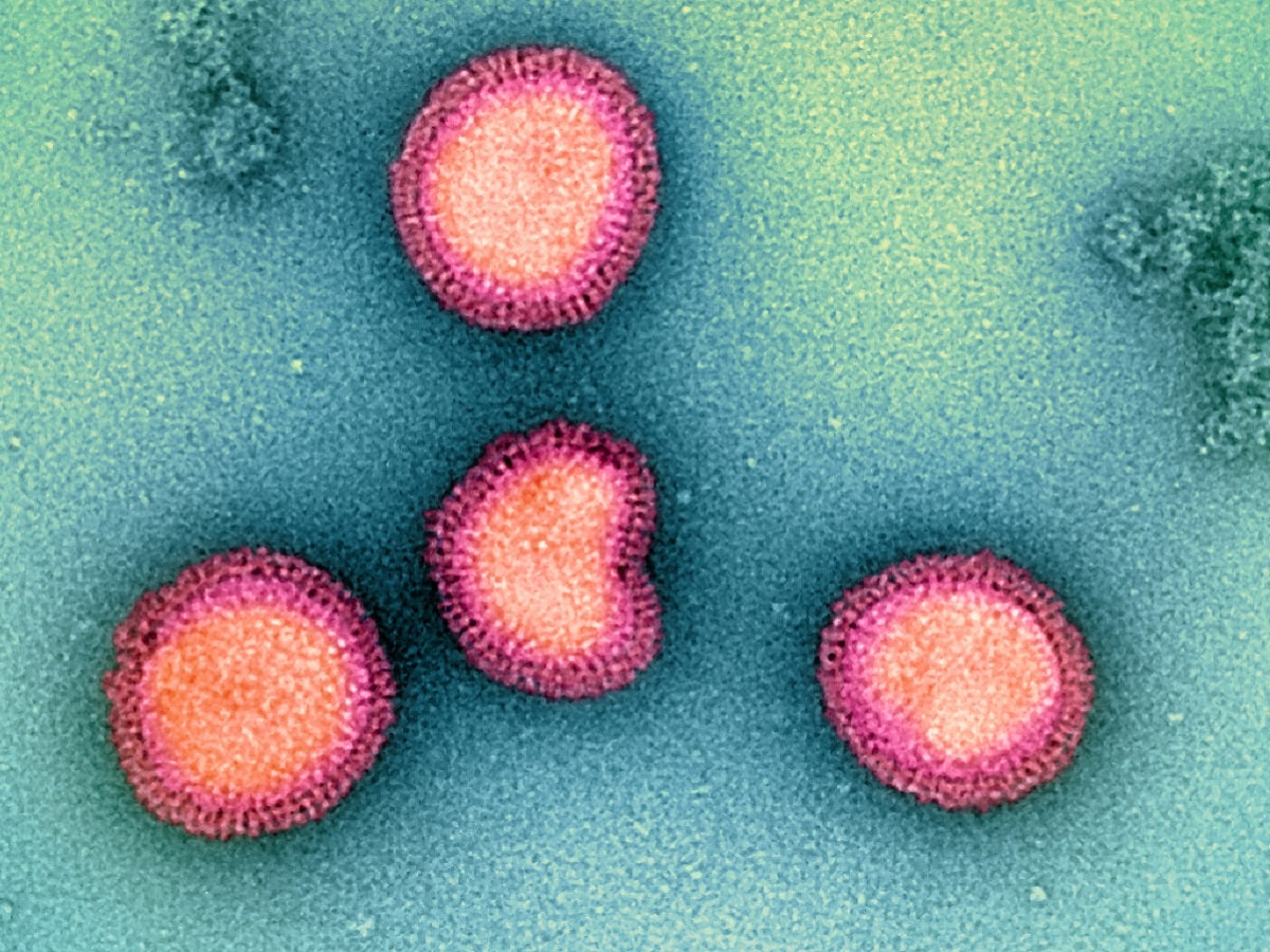 Human Coronavirus HKU1 Detected in Kolkata: Symptoms and Precautions