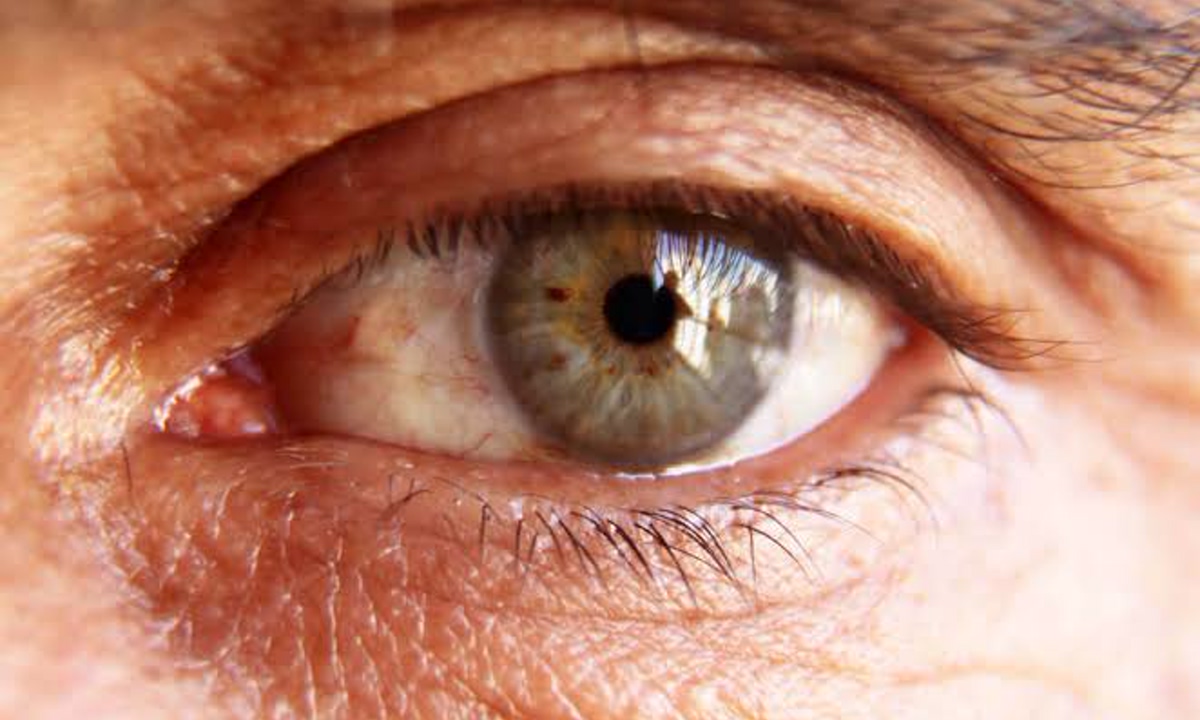 Diabetes and Eye Health: Don’t Ignore These Warning Signs