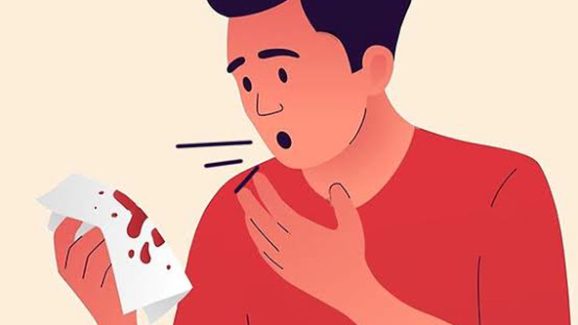 Can You Get TB? Find Out Who’s Most at Risk and What to Do