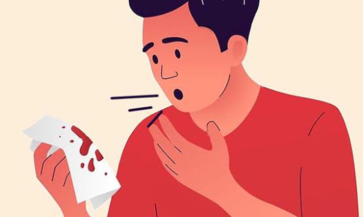 Can You Get TB? Find Out Who’s Most at Risk and What to Do