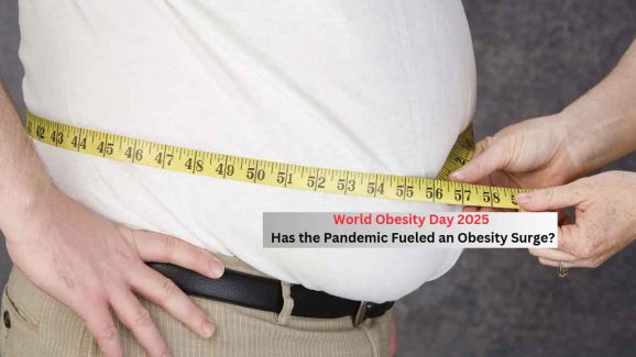 World Obesity Day 2025: Has Obesity Increased After the Pandemic?