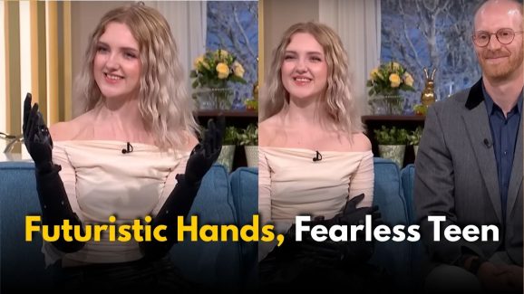 The World’s Most Advanced Bionic Arms: Real-Life Supergirl