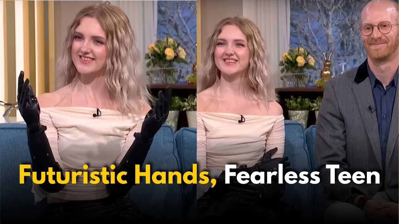 The World’s Most Advanced Bionic Arms: Real-Life Supergirl