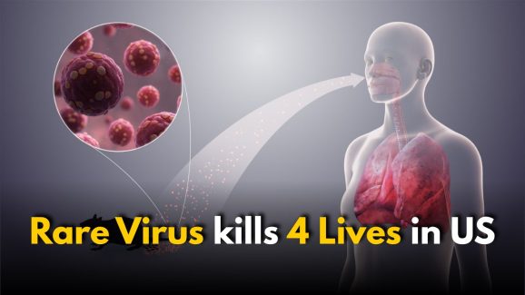 What is Hantavirus? kills 4 Lives Including Actor Gene Hackman’s Wife