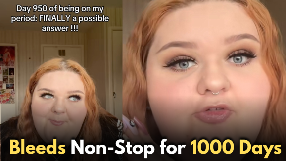 Woman Bleeds Non-Stop for 1000 Days