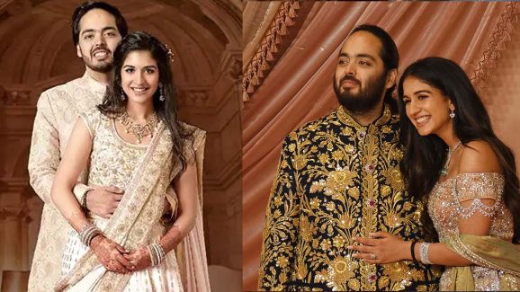 What is Cushing’s syndrome? Anant Ambani’s condition explained