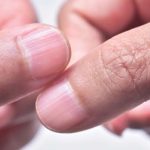 Signs of Vitamin B12 Deficiency You Should Never Ignore