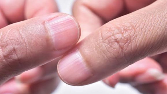 Signs of Vitamin B12 Deficiency You Should Never Ignore