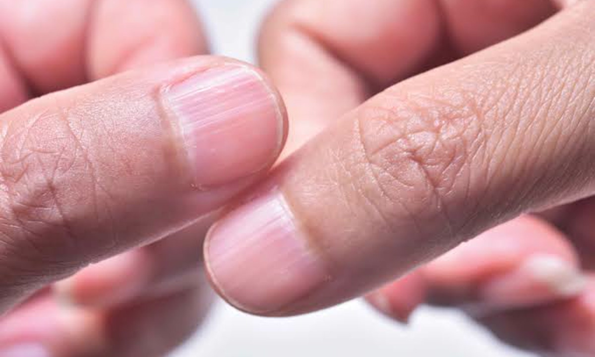 Signs of Vitamin B12 Deficiency You Should Never Ignore