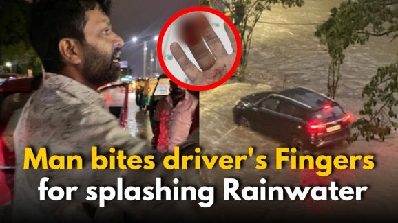 Bengaluru Man bites driver’s Finger for splashing Rainwater
