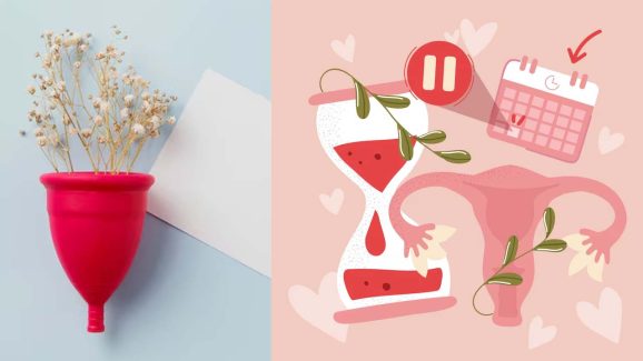 women’s health: Impact of Menstrual cups on Kidneys