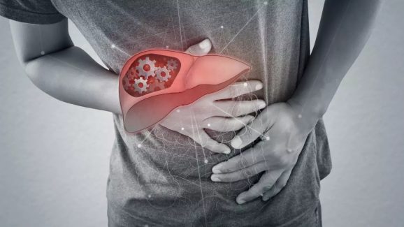 Fatty Liver Disease: Early Symptoms and What They Mean
