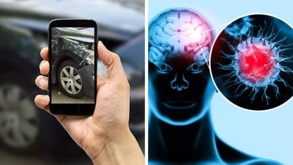 Does Excessive Phone Use Cause Brain Tumors?
