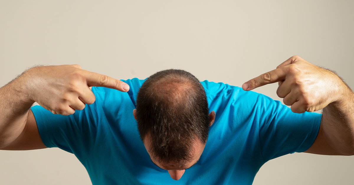 Hair Loss in Boys: Common Mistakes That Cause Baldness Early