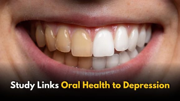 Did You Know That Depression Might Start in Your Mouth
