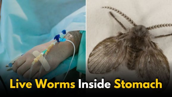 How Did an 8-Year-Old Girl Vomit live Worms for Weeks?