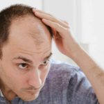 Regrow Hair on Blad Patches with These 5 Chinese Herbs