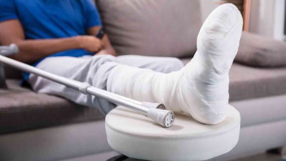 Employee Quits After Manager Asks Him to Work With Broken Leg