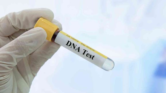 Guide to DNA Testing in India: Cost, Time, Rules, and More Explained