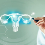 Top Ways to Reduce Your Ovarian Cancer Risk