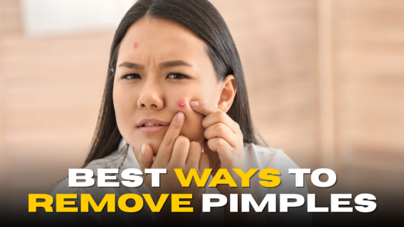 Clear Skin at Home: Best Ways to Remove Pimples