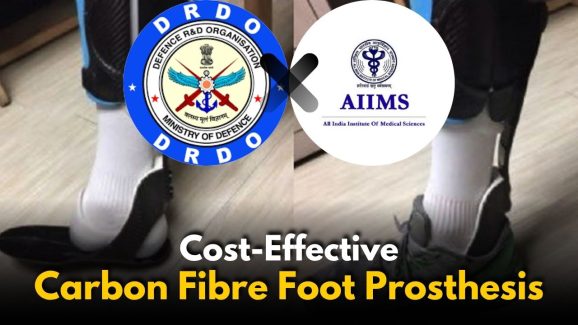 AIIMS Bibinagar and DRDL Launch New Carbon Foot Prosthesis
