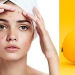 Lemon Bleach For Face: How to Safely Brighten Your Skin at Home