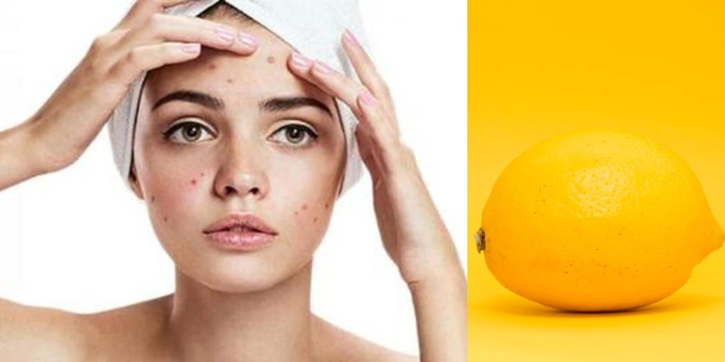 Lemon Bleach For Face: How to Safely Brighten Your Skin at Home