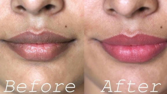 How to Get Rid of Dark Lips: Easy Natural Tip