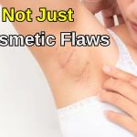 Why Dark Underarms Might Mean Health Trouble Not Just A Skin Issue