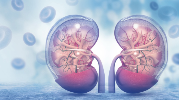 What Is Thulium Fiber Laser? A New Way to Treat Kidney Stones