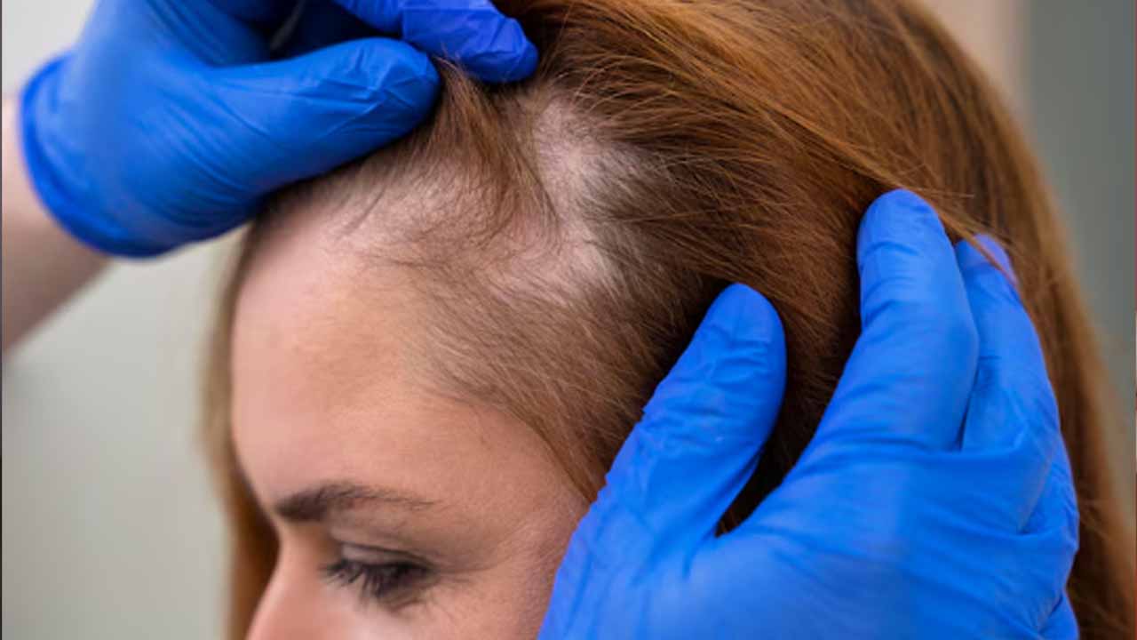 Hidden Reasons Of Hair Loss That Experts Explain But Never Tell You