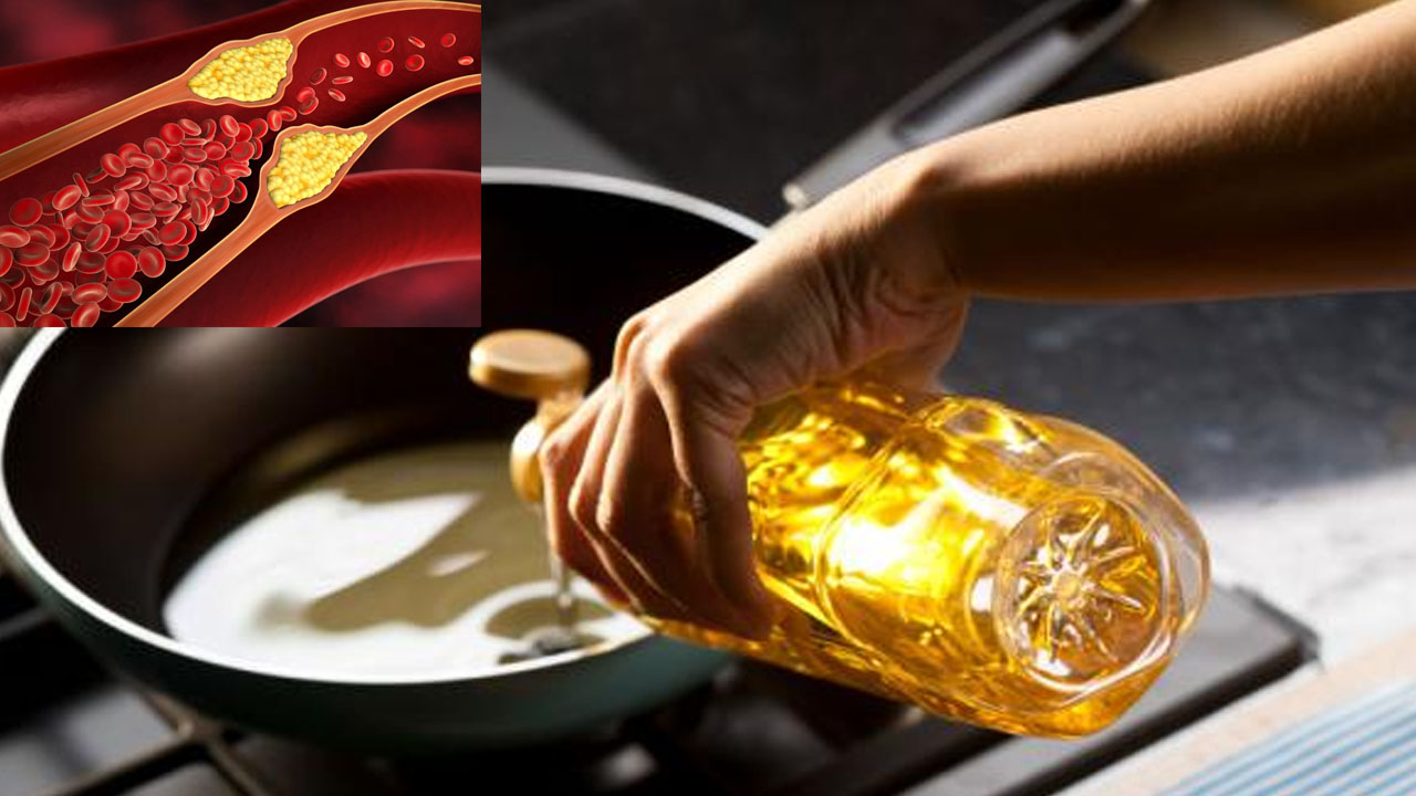 Is Palm Oil Sneaking Into Your Diet? Know The Hidden Health Risk