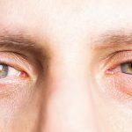 Sleep Deprivation Is Silently Destroying Your Eyesight – Here’s Why