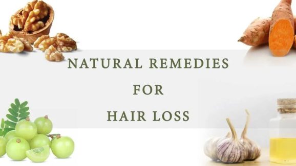 Bid Goodbye to Baldness in 2 Months with These Secret Hair Formulas