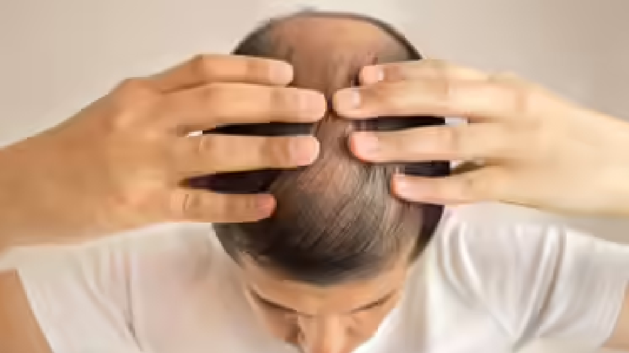 Hair Loss in Your 20s and 30s: Key Triggers You Didn’t Know About