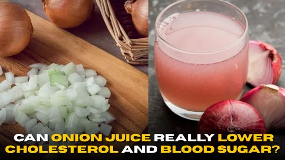 Onion Juice: Can It Really Lower Cholesterol and Blood Sugar?
