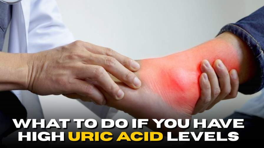 What to Do If You Have High Uric Acid Levels