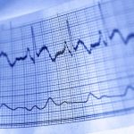 Want to Start Gym? These 5 Heart Tests Are Crucial for Your Safety