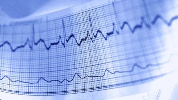 Want to Start Gym? These 5 Heart Tests Are Crucial for Your Safety