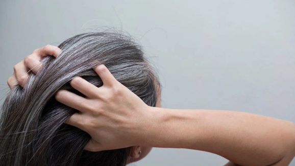 Stop White Hair With These 6 Simple Remedies