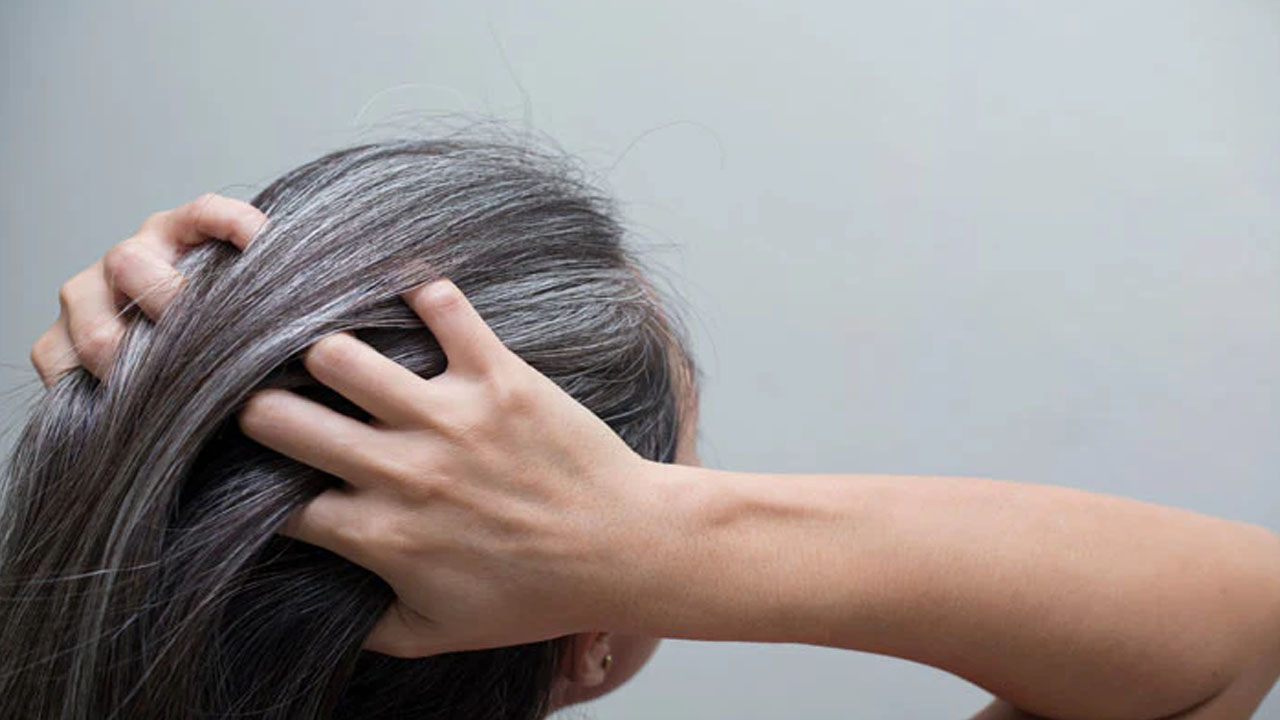 Stop White Hair With These 6 Simple Remedies