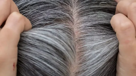 Get Rid of White Hair and Stop Hair Fall with This Vegetable Juice