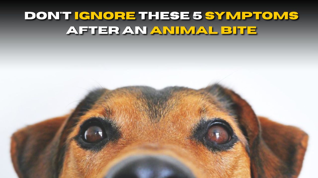 Don’t Ignore These 5 Symptoms After an Animal Bite