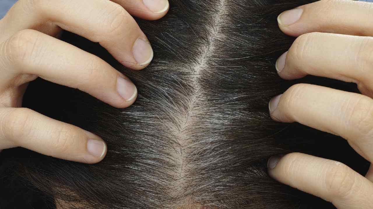 Does Hair Dye Really Increase White Hair?