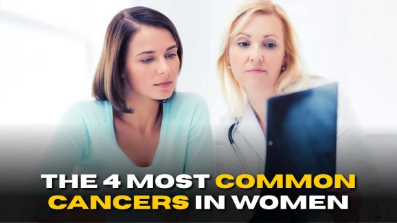 The Four Most Common Cancers in Women